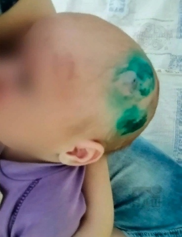 Неадекватная женщина била и кусала своего маленького ребенка. Случай произошел в Челябинске. Пациентки